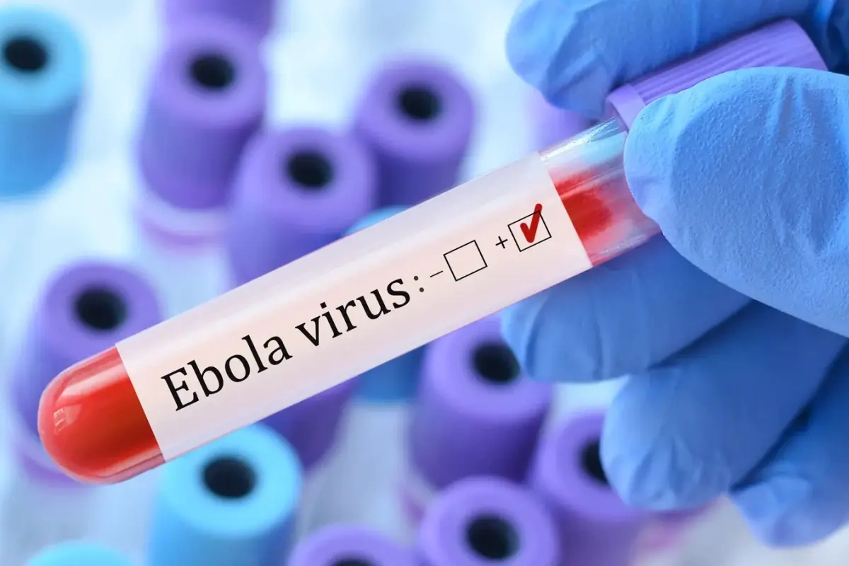 Ebola virusundan ölənlərin sayı artd