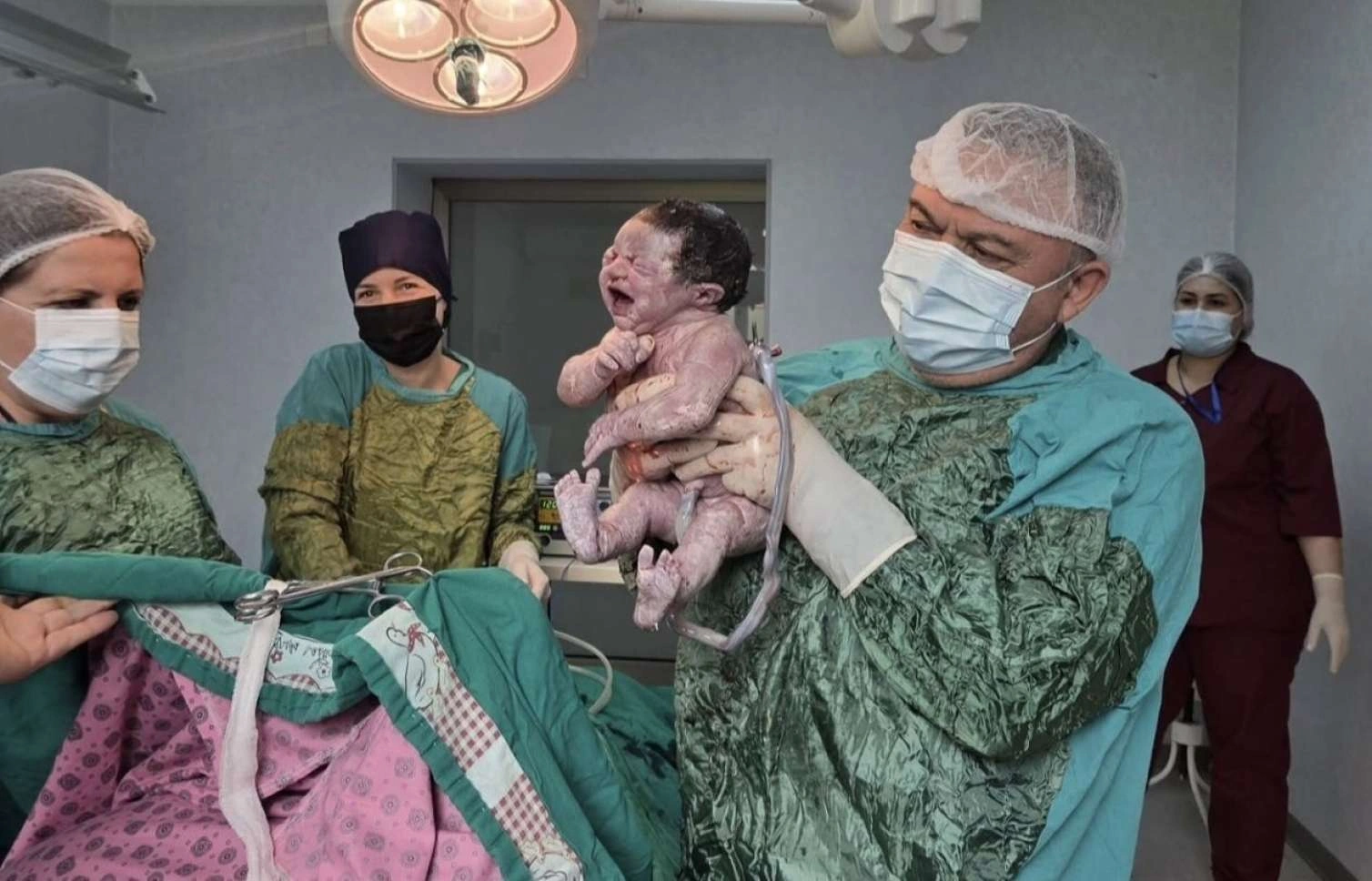 Azərbaycanda serebral iflic olan qadın