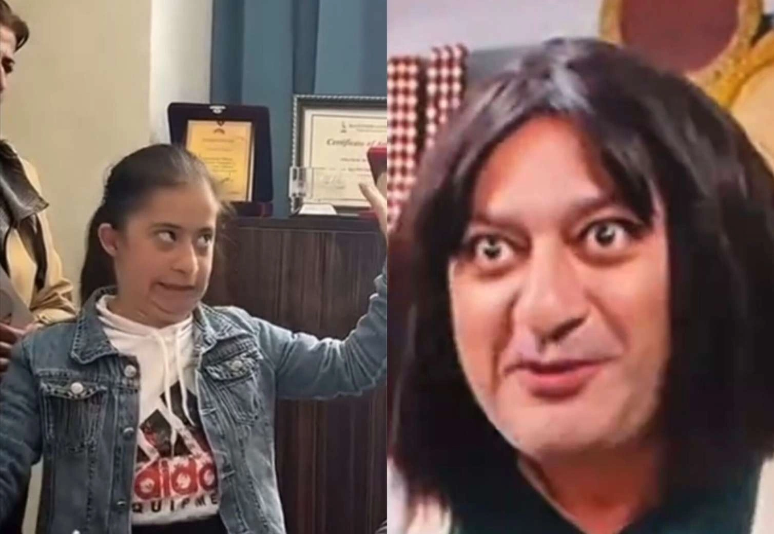 Autizmli uşağı parodiya edən aktyor tənqid olundu: