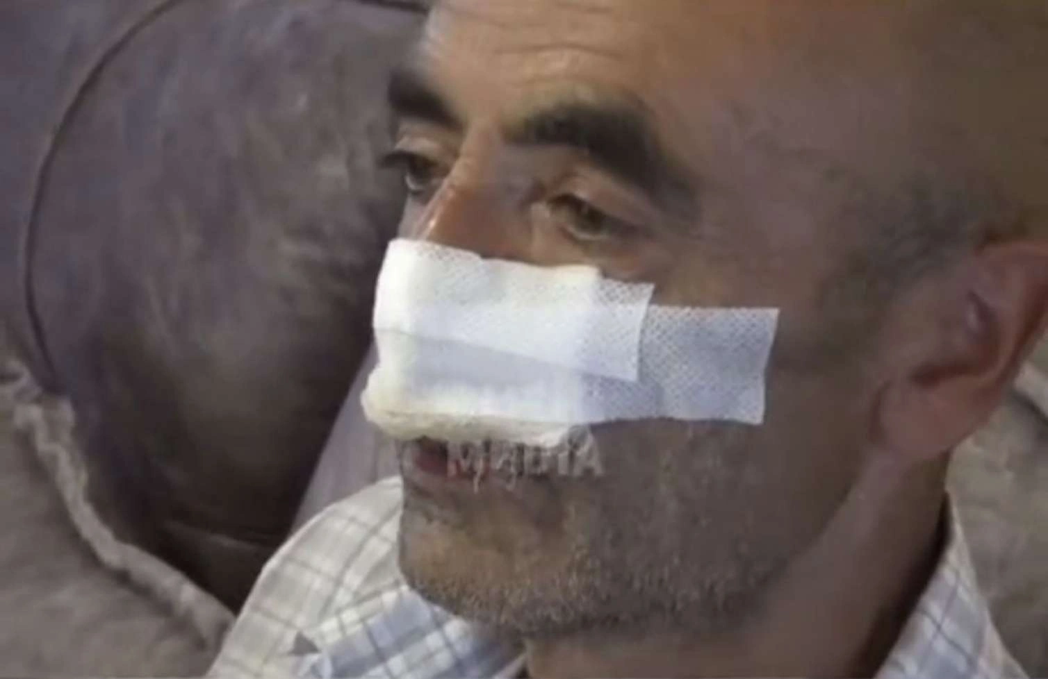 Küçə itləri 60 yaşlı kişinin burnunu