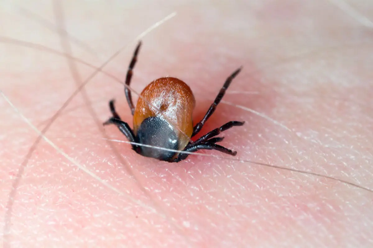 Gənə sancması ilə yayılan yeni virus aşkarlandı