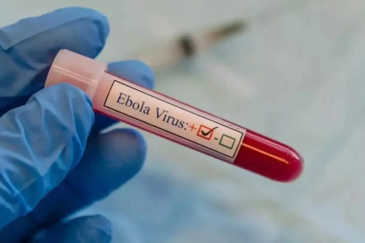 Ebola virusuna yoluxma artmaqda davam edir