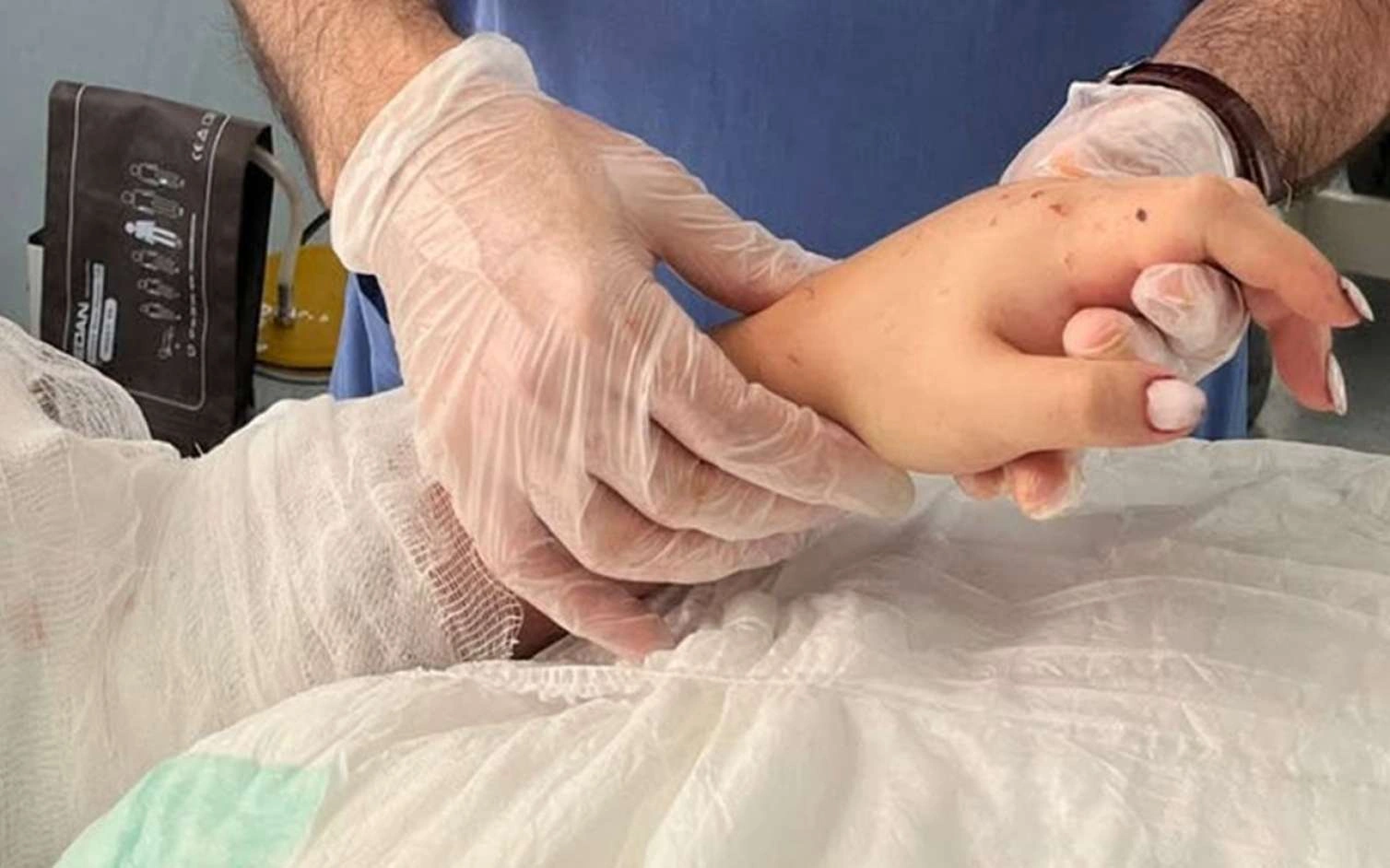 Bakıda 29 yaşlı qadının qopmuş qolu bərpa olundu