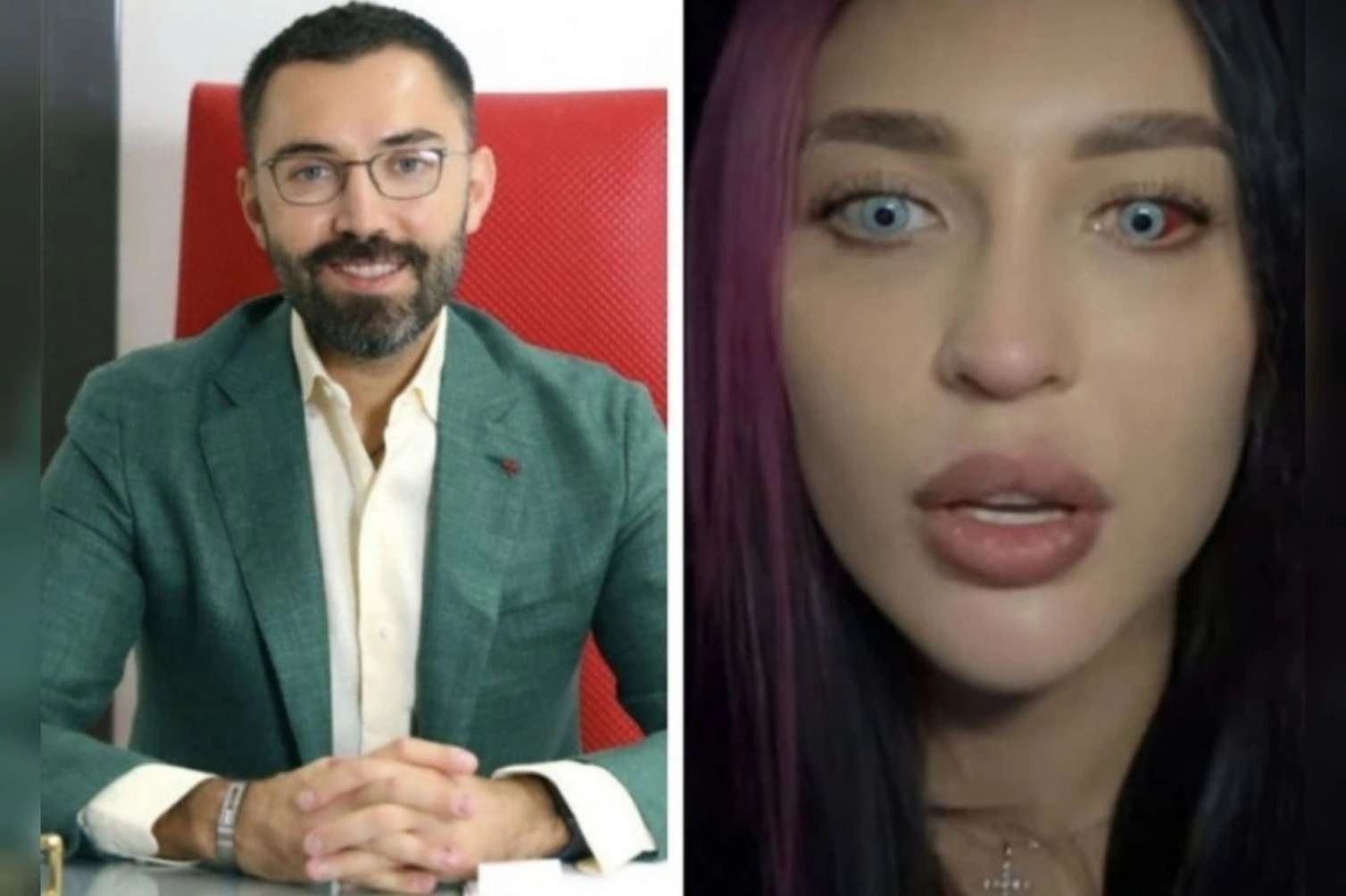 Bakıda göz rəngini dəyişdirdi, görməsi zəiflədi –