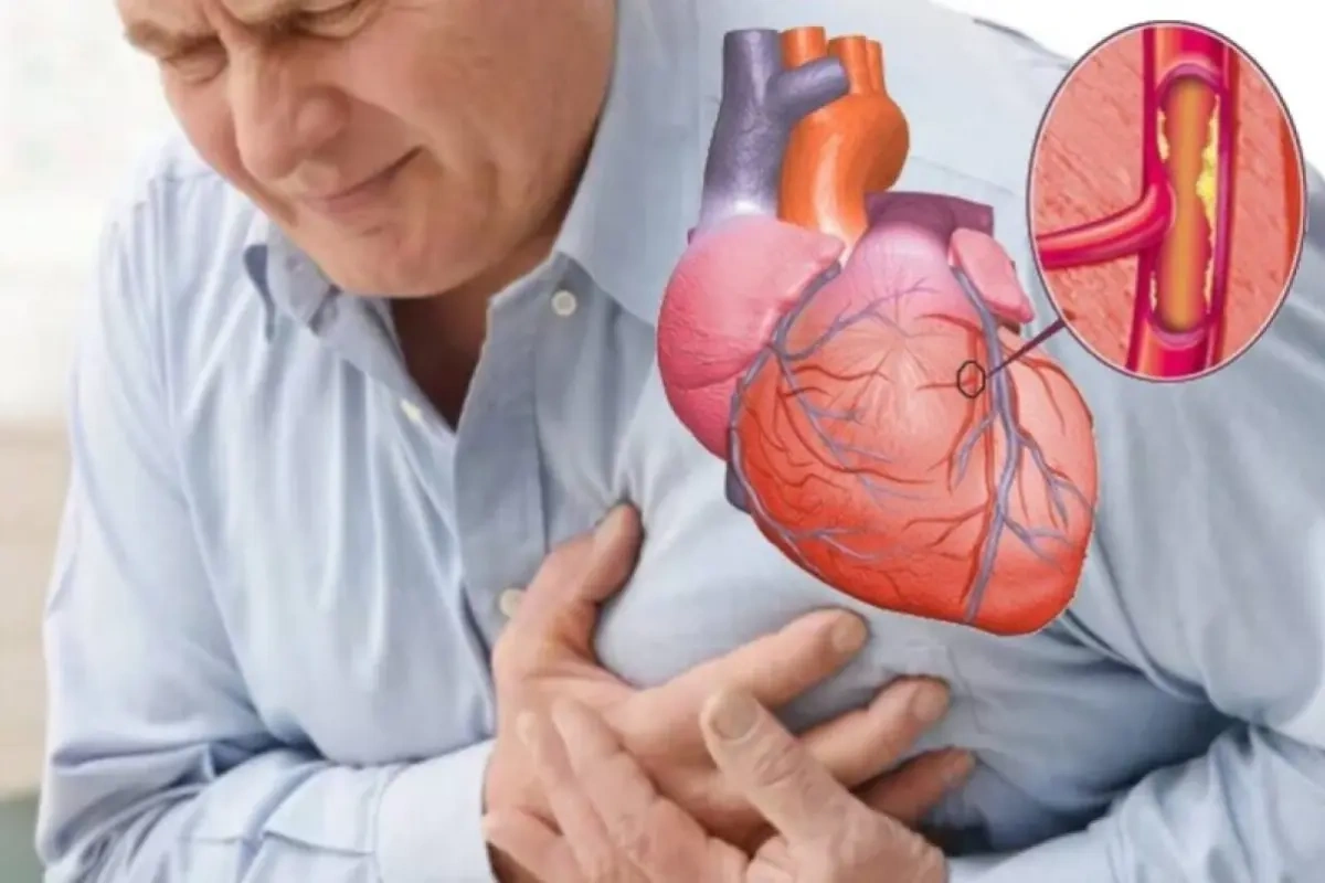 Ürəkdəki bu problem ani ölümə səbəb ola bilər - DİQQƏT