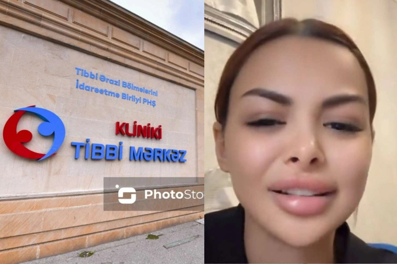 "Tibb bacıları xalama su vermədilər ki, onsuz da ölürsən" –