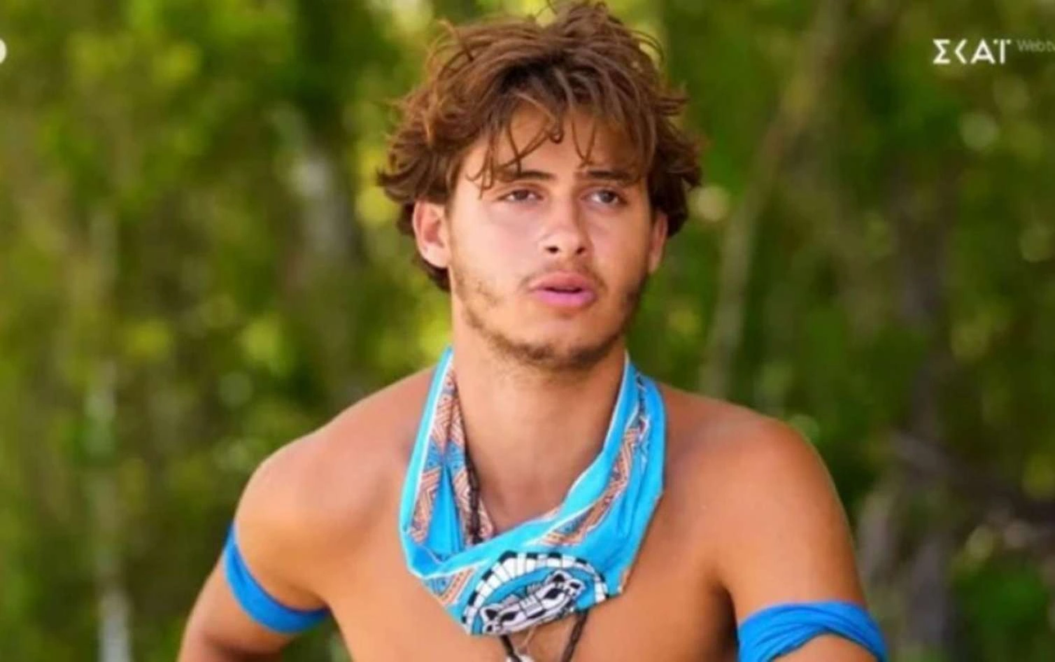 “Survivor”da faciə - İştirakçının ayağı amputasiya edildi