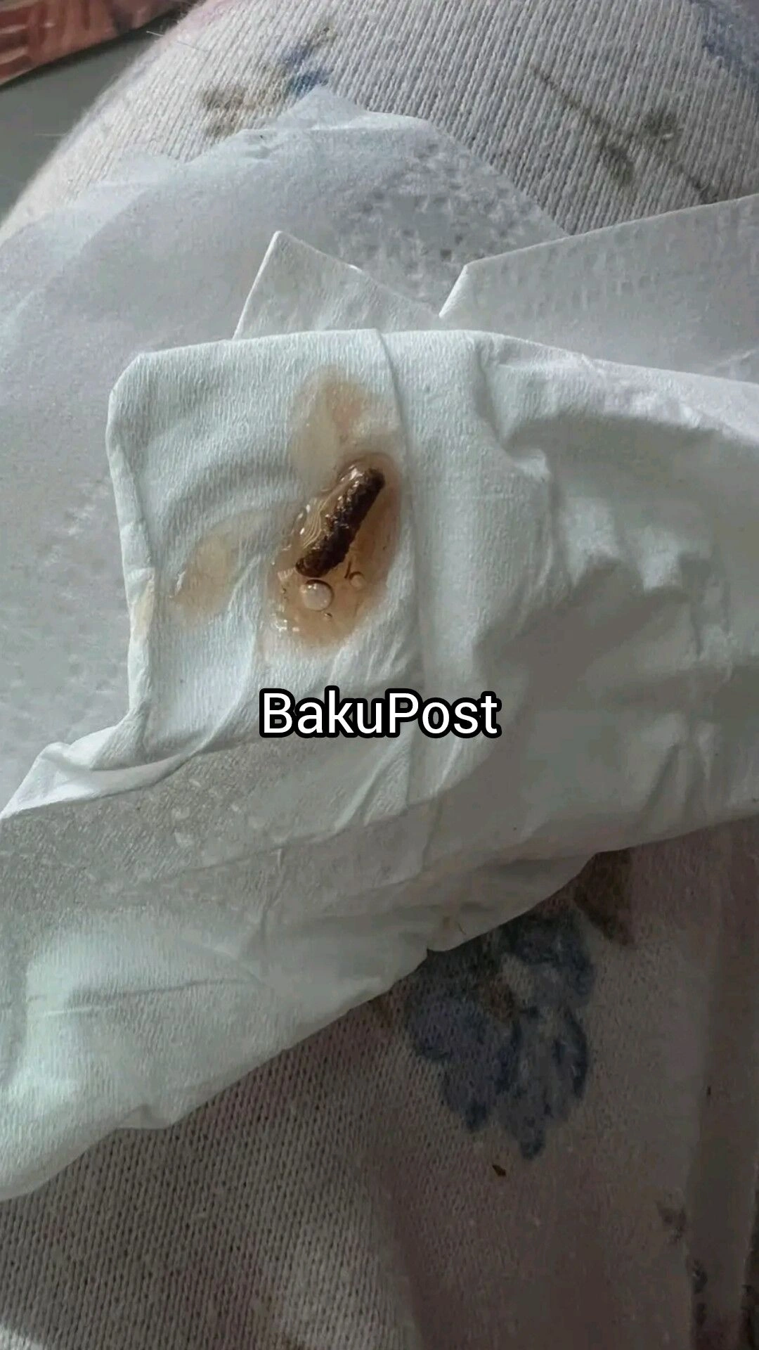 Content Image